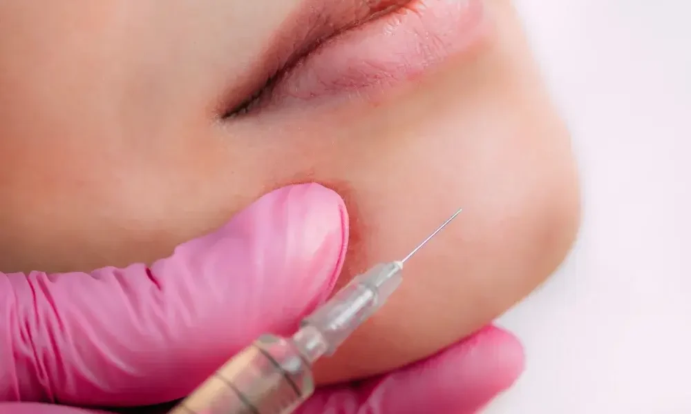 Fillers (1) Fillers (1)
