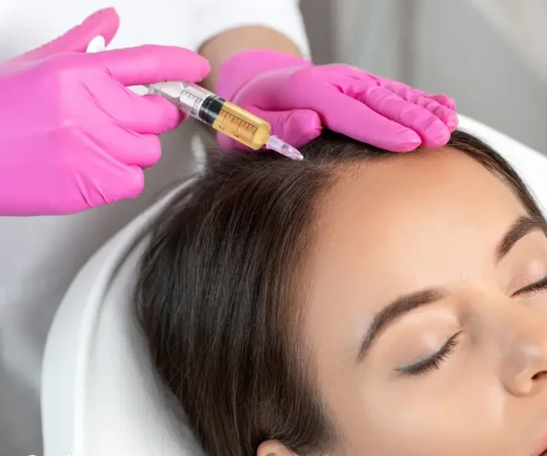 PRP for Hair PRP for Hair