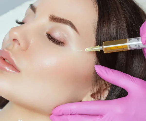 PRP for face PRP for face